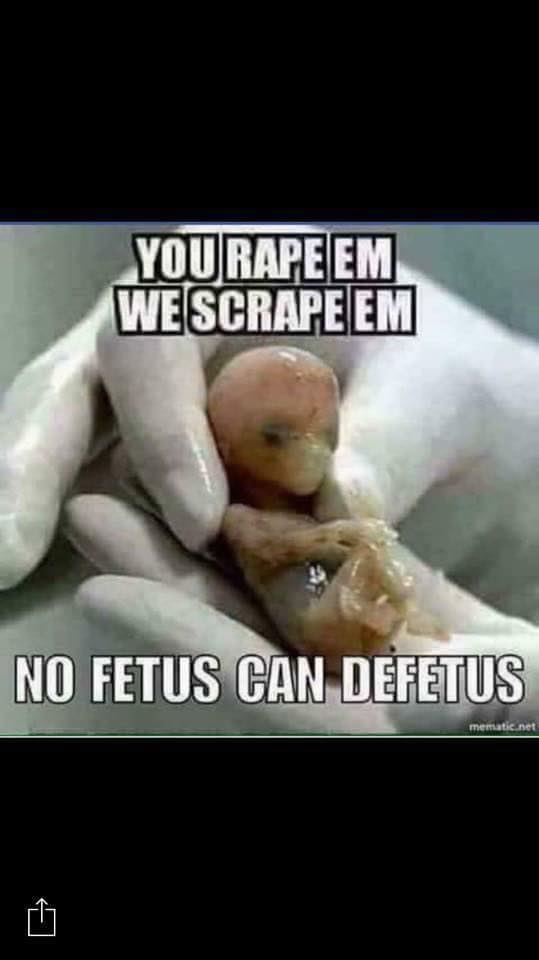 No Fetus Can Defetus (539x960 31kb)